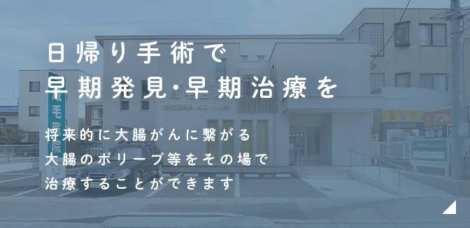 日帰り手術で早期発見・早期治療を 将来的に大腸がんに繋がる大腸のポリープ等をその場で治療することができます<br>※手術自体は当日で完了しますが、術前の検査、術後の経過観察のために通院していただく場合があります。